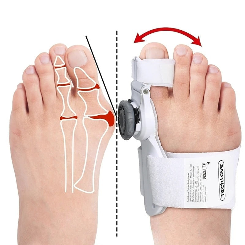 Adjustable Toe Bunion Corrector Orthopedic Splint for Alignment & Pain Relief