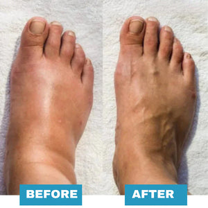 Electric EMS Foot Massage Mat – Relieves Pain & Stimulates Muscles